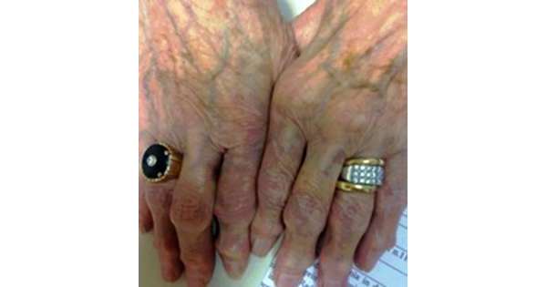                        Truffe anziani, 5 arresti Cc          